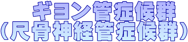    ギヨン管症候群 （尺骨神経管症候群）